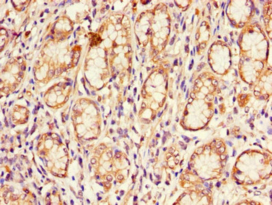 Immunohistochemistry of paraffin-embedded human stomach tissue using CSB-PA005092LA01HU at dilution of 1:100