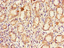 Immunohistochemistry of paraffin-embedded human stomach tissue using CSB-PA005092LA01HU at dilution of 1:100
