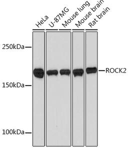 Western blot - ROCK2  Rabbit mAb (A2395)