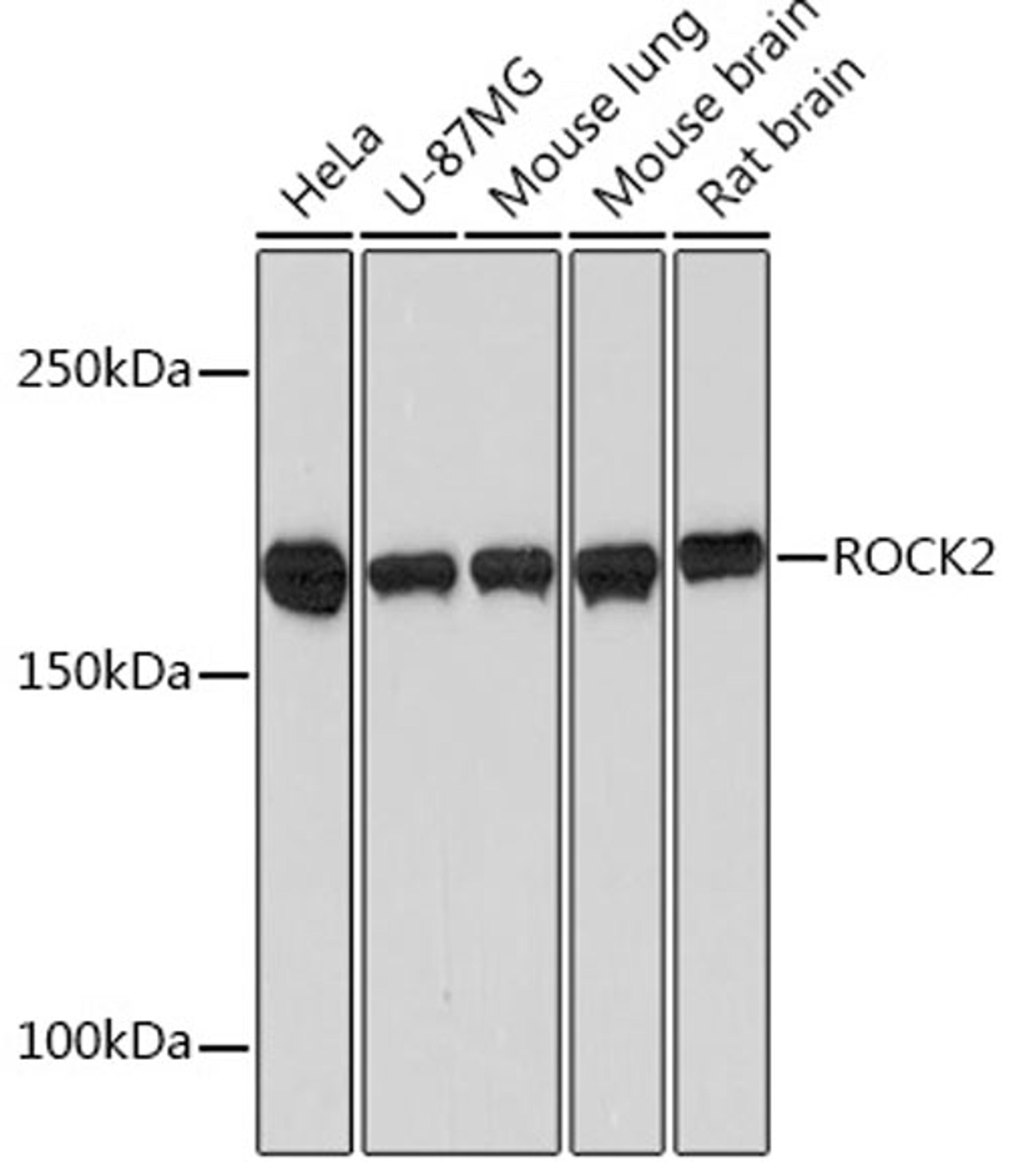 Western blot - ROCK2  Rabbit mAb (A2395)