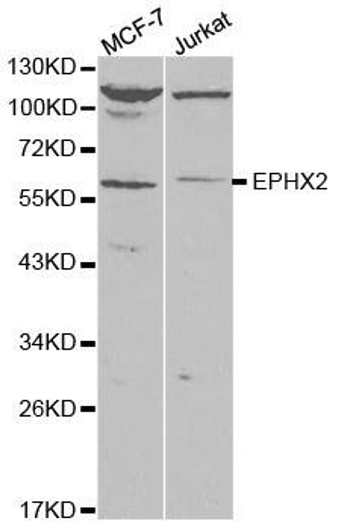 Western blot analysis of extracts of various cell lines using EPHX2 antibody