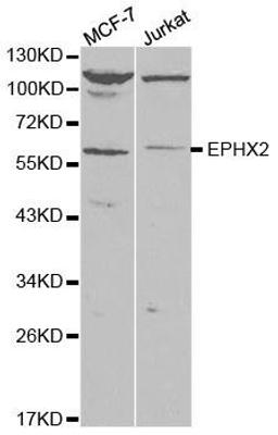 Western blot analysis of extracts of various cell lines using EPHX2 antibody