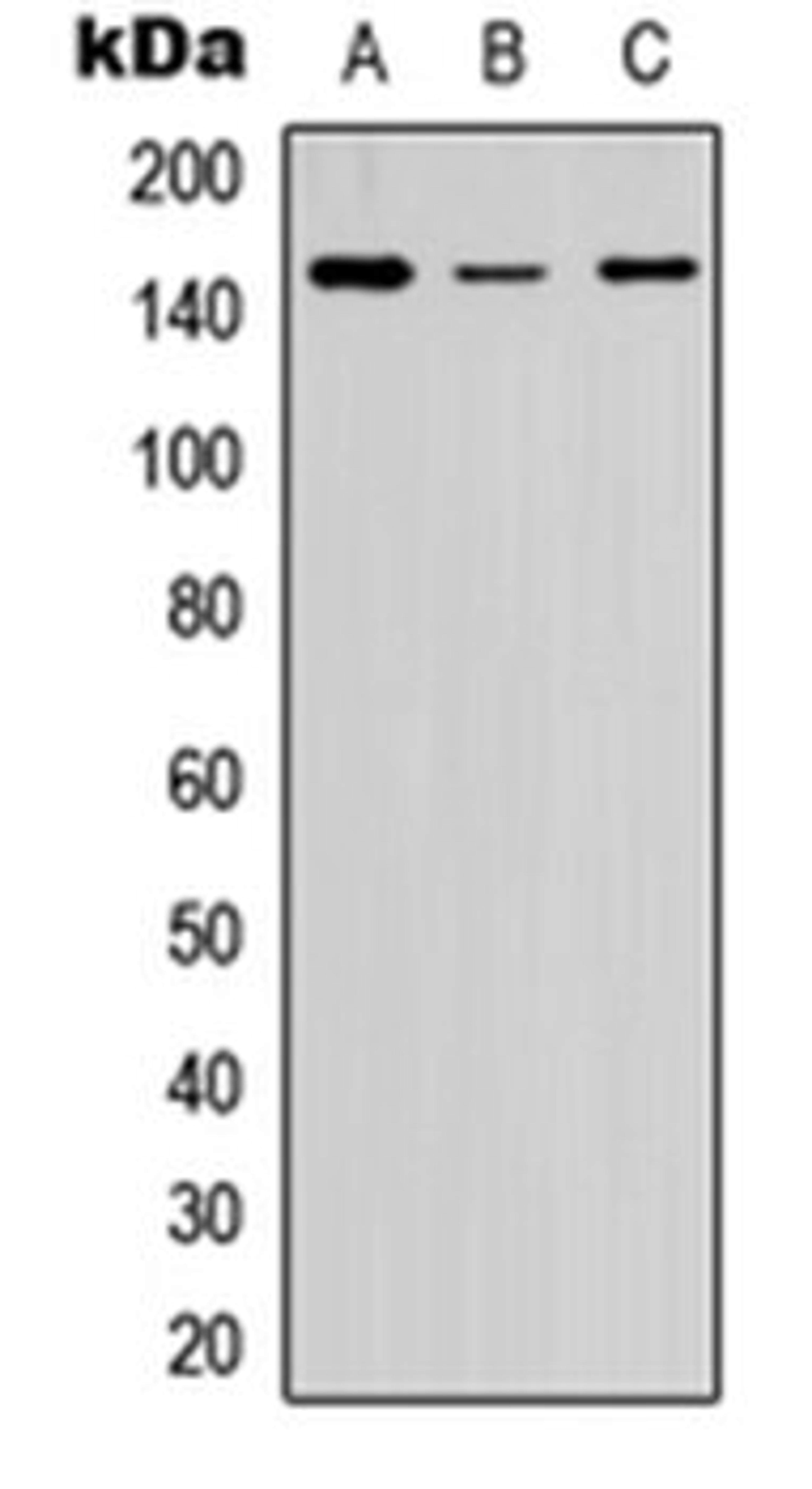 Western blot analysis of HEK293T (Lane 1), Raw264.7 (Lane 2), PC12 (Lane 3) whole cell lysates using Collagen 5 alpha 2 antibody