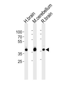 Western blot analysis of lysates from human brain, mouse cerebellum and rat brain tissue lysate (from left to right), using ALDOC Antibody at 1:1000 at each lane.