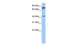 Antibody used in WB on Human 721_B cells at 0.2-1 ug/ml.