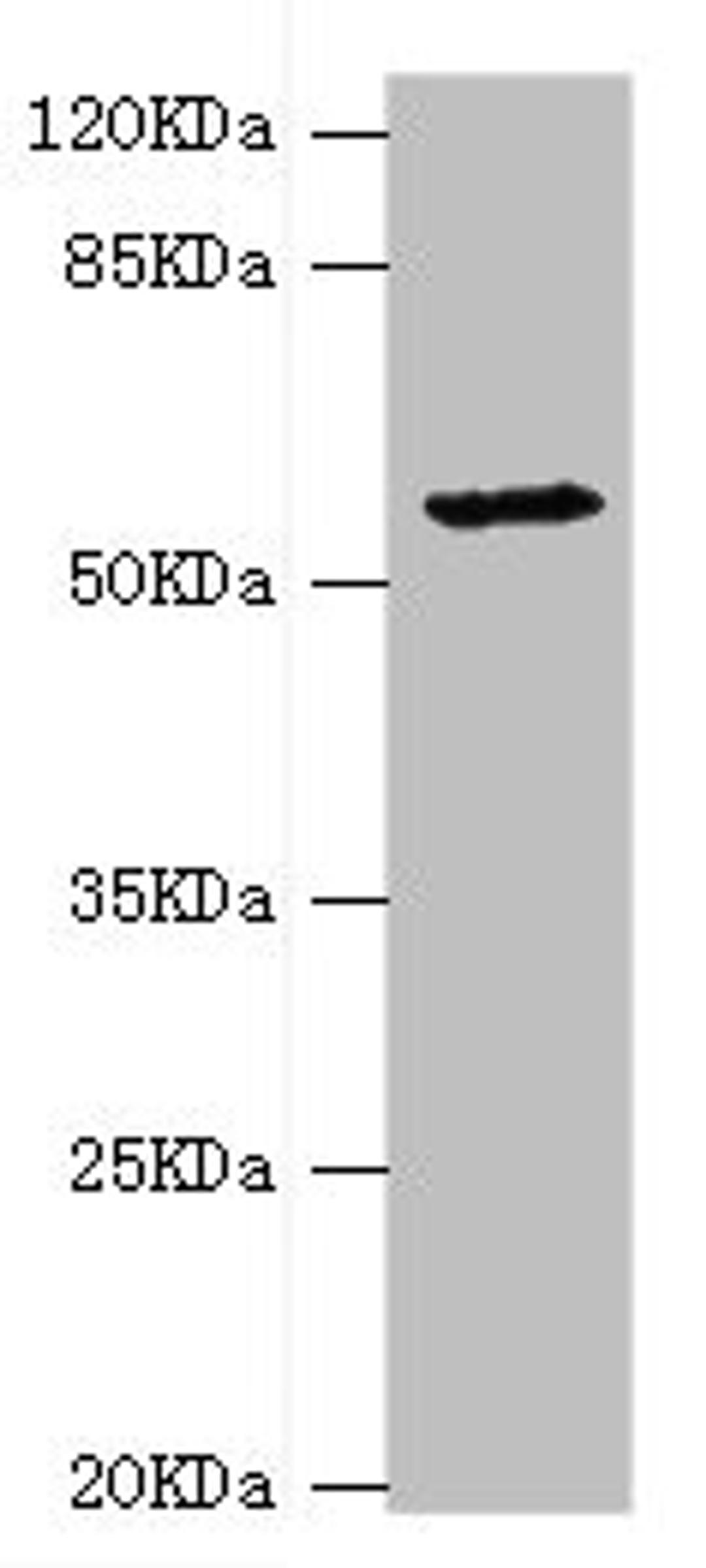 Western blot. All lanes: DPYS antibody at 1.34ug/ml + Mouse liver tissue. Secondary. Goat polyclonal to rabbit IgG at 1/10000 dilution. Predicted band size: 57 kDa. Observed band size: 57 kDa.