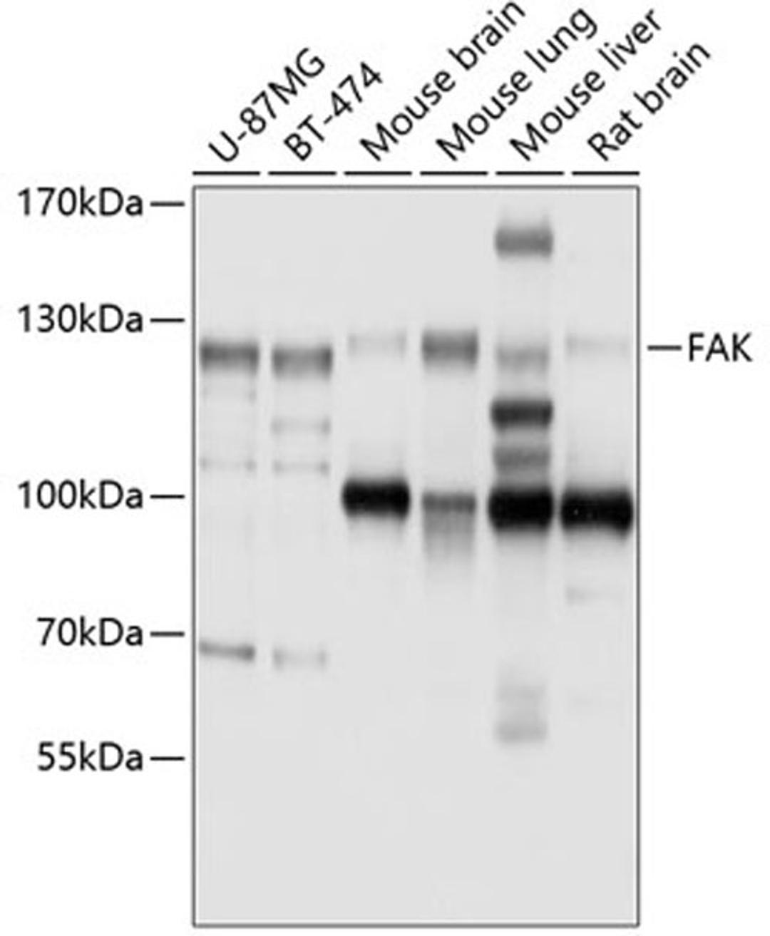 Western blot - FAK antibody (A11531)