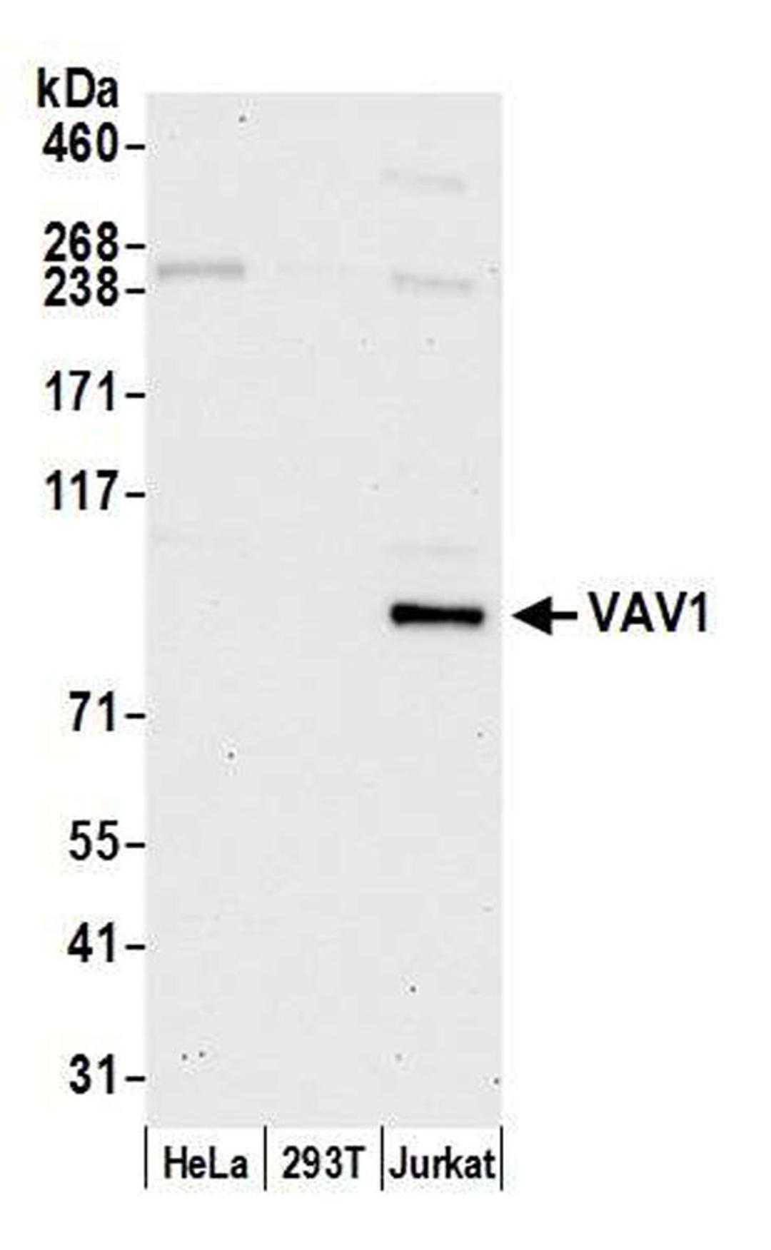 Detection of human VAV1 by WB.