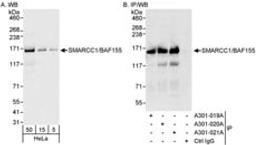 Detection of human SMARCC1/BAF155 by western blot and immunoprecipitation.