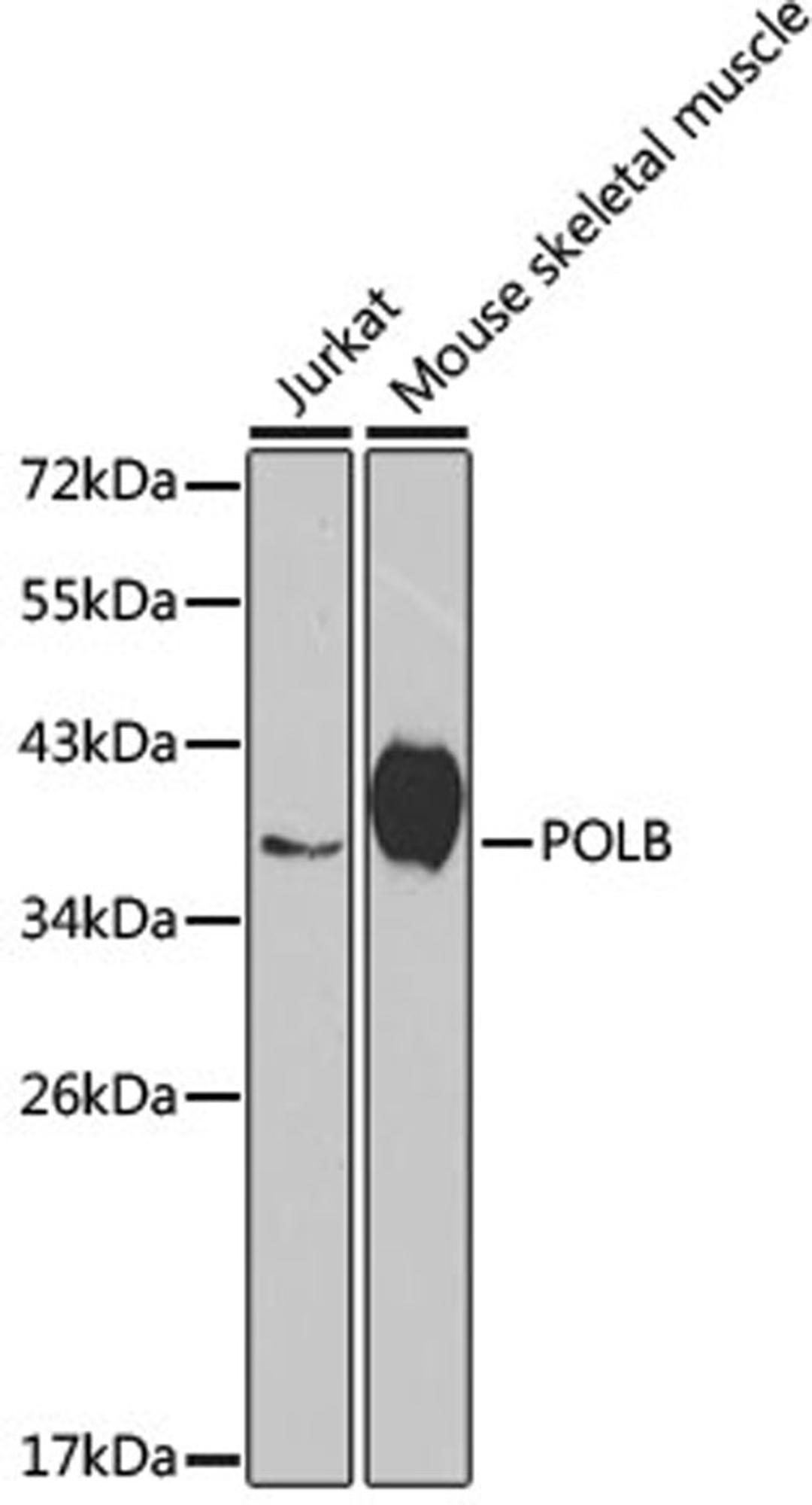 Western blot - POLB antibody (A1681)