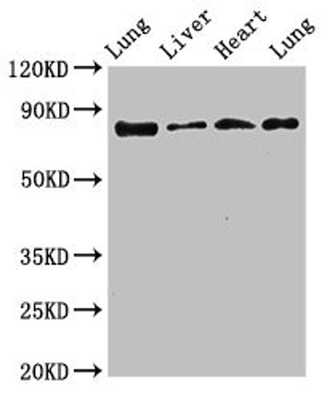 Western Blot. Positive WB detected in: Rat lung tissue, Rat liver tissue, Mouse heart tissue, Mouse lung tissue. All lanes: LOXL2 antibody at 3.5ug/ml. Secondary. Goat polyclonal to rabbit IgG at 1/50000 dilution. Predicted band size: 87 kDa. Observed band size: 87 kDa.