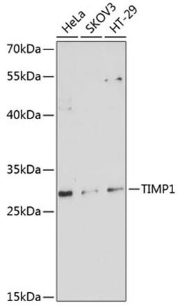 Western blot - TIMP1 antibody (A1389)