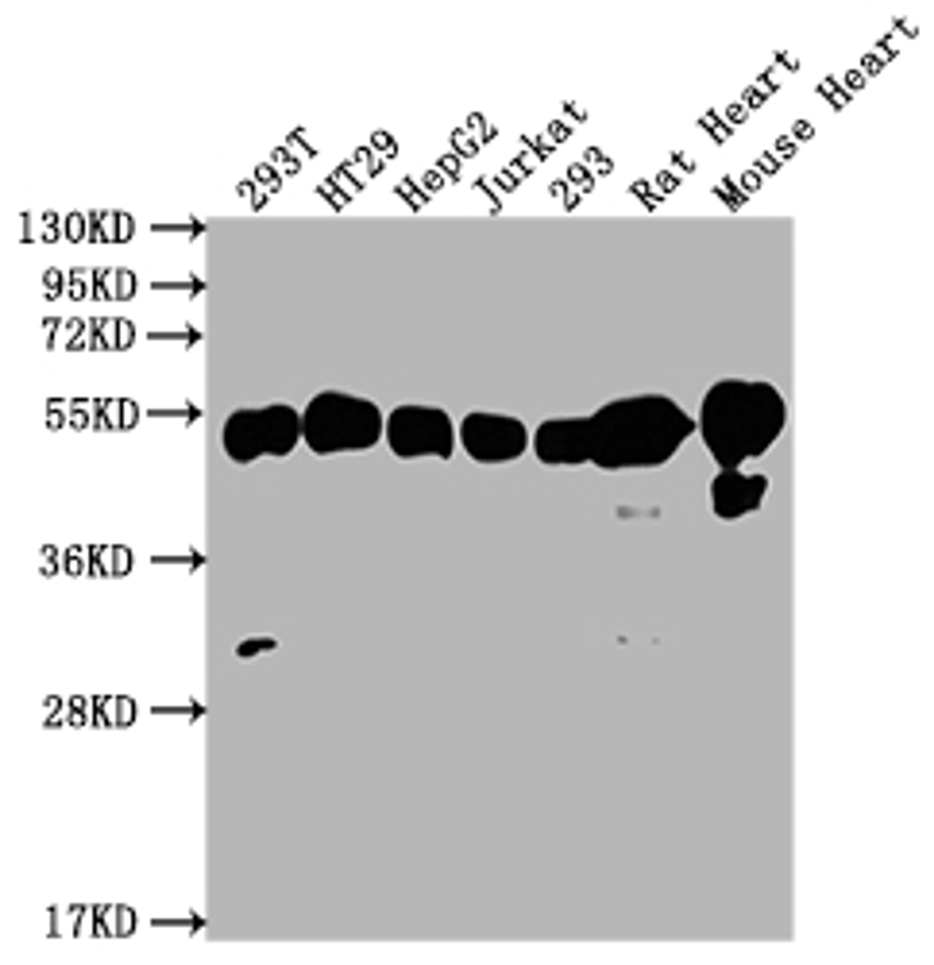 Western Blot. Positive WB detected in: 293T whole cell lysate, HT29 whole cell lysate, HepG2 whole cell lysate, Jurkat whole cell lysate, 293 whole cell lysate, Rat Heart tissue, Mouse Heart tissue. All lanes: ATP5F1B antibody at 1:2000. Secondary. Goat polyclonal to rabbit IgG at 1/50000 dilution. Predicted band size: 57 kDa. Observed band size: 57 kDa.