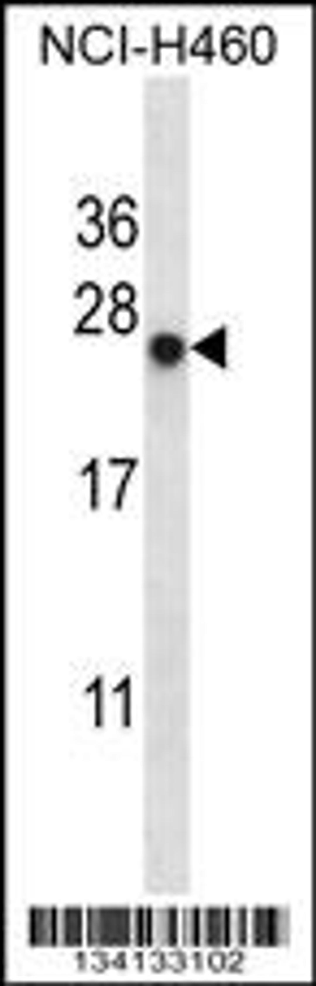 Western blot analysis in NCI-H460 cell line lysates (35ug/lane).