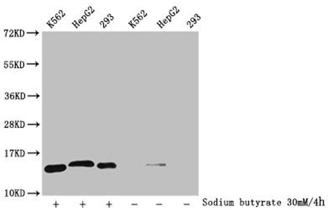 Western Blot. Detected samples: K562 whole cell lysate, HepG2 whole cell lysate, 293 whole cell lysate; Untreated (-) or treated (+) with 30mM sodium butyrate for 4h. All lanes: HIST1H2BC antibody at 1:300. Secondary. Goat polyclonal to rabbit IgG at 1/50000 dilution. Predicted band size: 14 kDa. Observed band size: 14 kDa