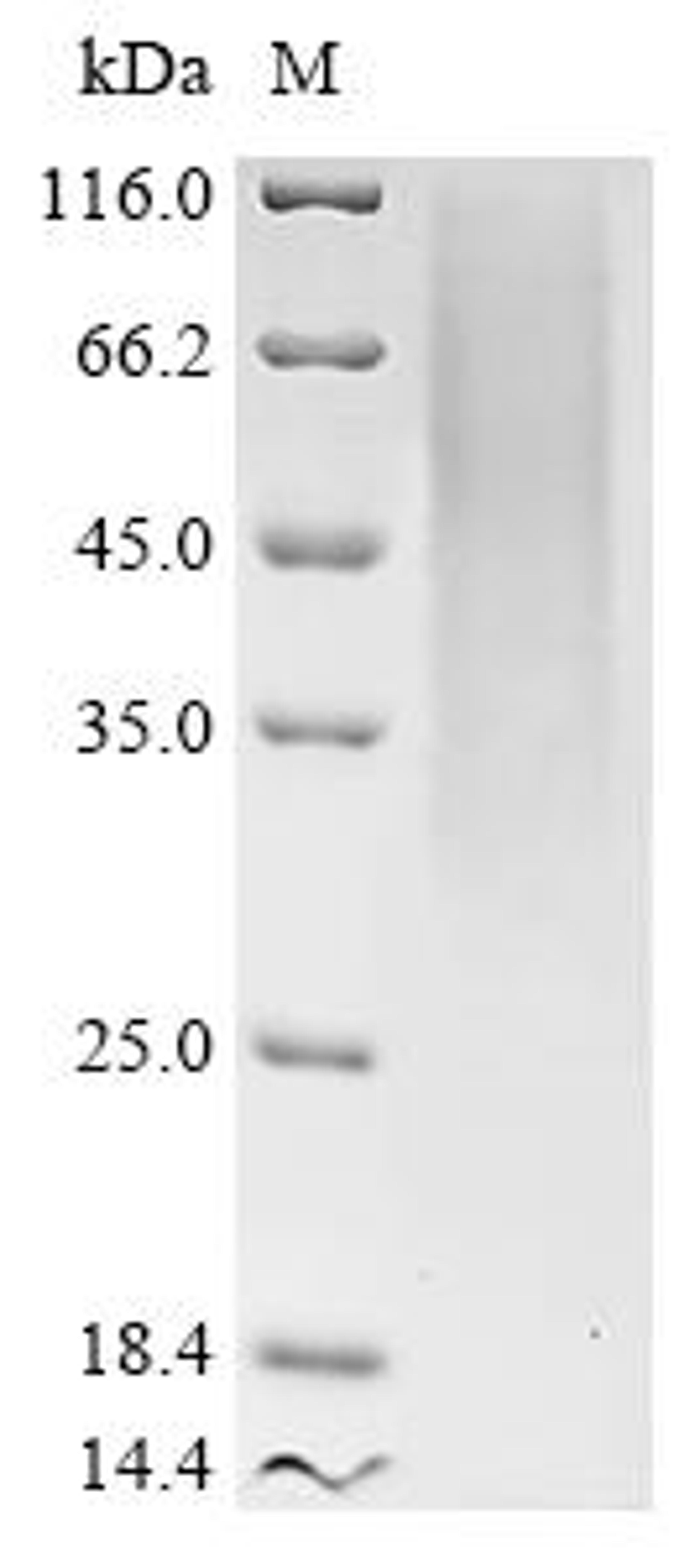 (Tris-Glycine gel) Discontinuous SDS-PAGE (reduced) with 5% enrichment gel and 15% separation gel.