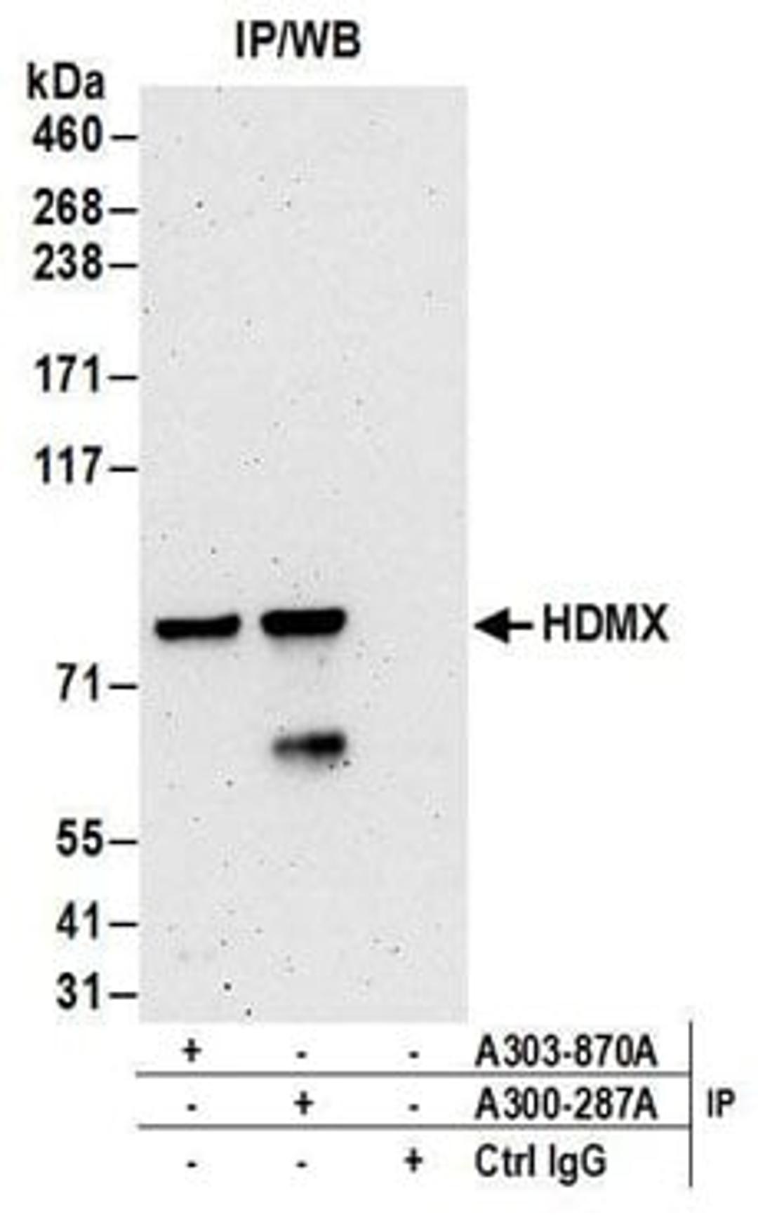 Detection of human HDMX by western blot of immunoprecipitates.