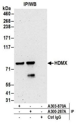 Detection of human HDMX by western blot of immunoprecipitates.