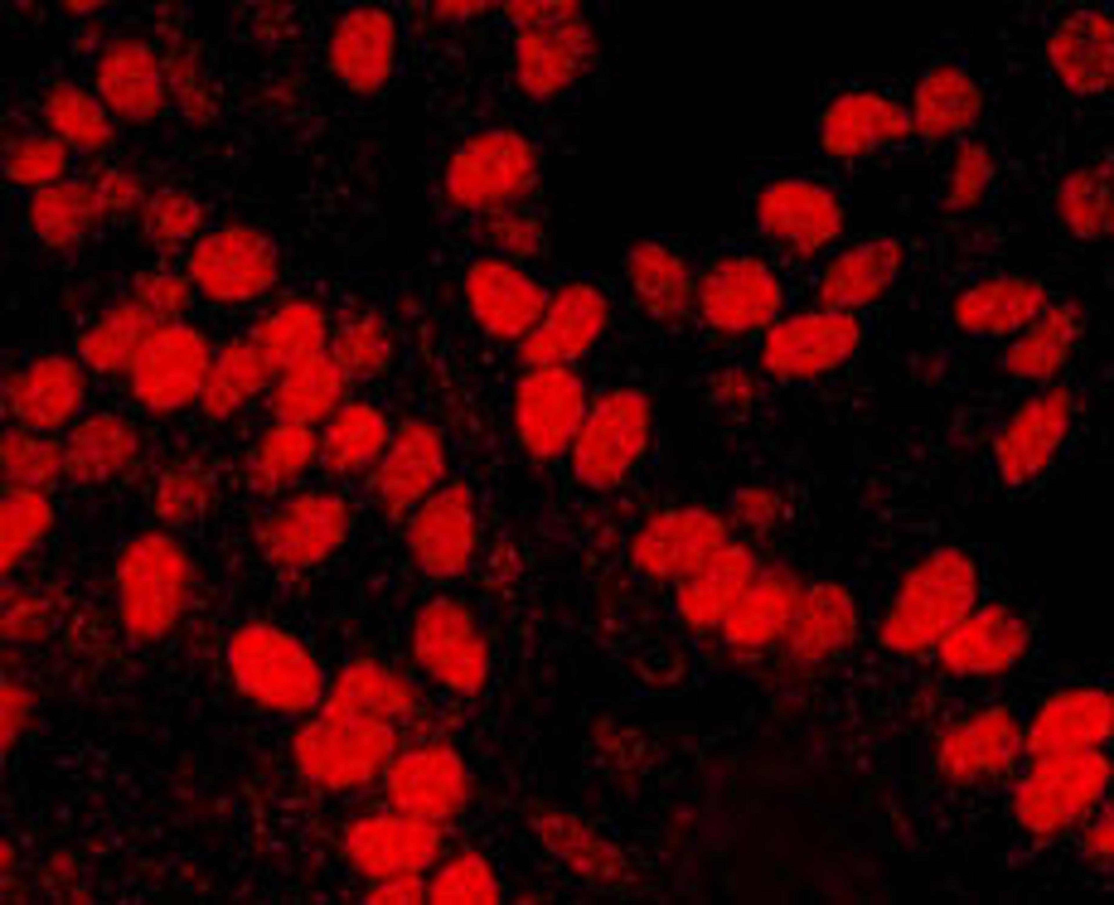 Detection of human and mouse HMGN1 by immunohistochemistry.