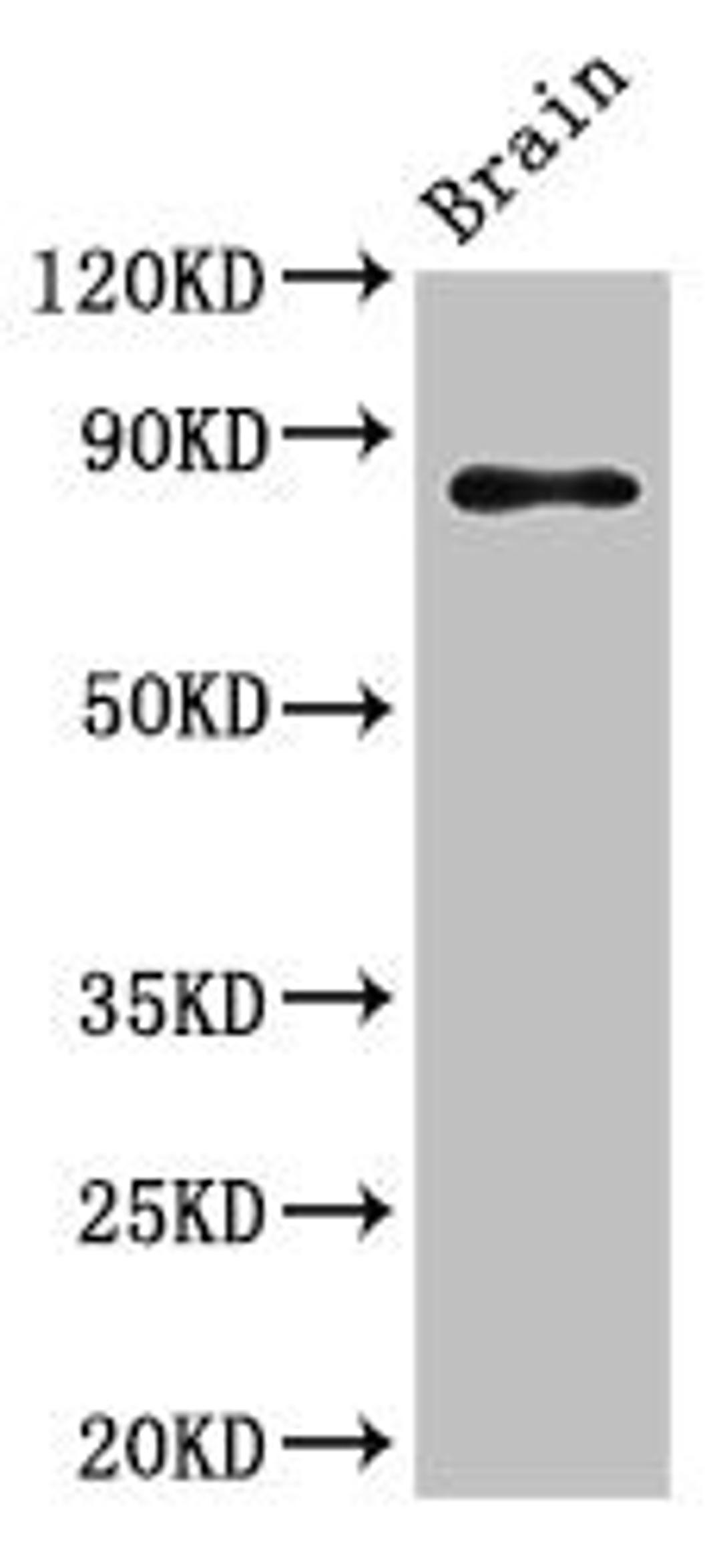 Western Blot. Positive WB detected in: Mouse brain tissue. All lanes: GIT1 antibody at 3.5ug/ml. Secondary. Goat polyclonal to rabbit IgG at 1/50000 dilution. Predicted band size: 85, 20, 86 kDa. Observed band size: 85 kDa. 