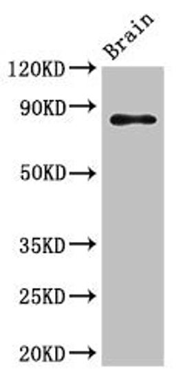 Western Blot. Positive WB detected in: Mouse brain tissue. All lanes: GIT1 antibody at 3.5ug/ml. Secondary. Goat polyclonal to rabbit IgG at 1/50000 dilution. Predicted band size: 85, 20, 86 kDa. Observed band size: 85 kDa. 