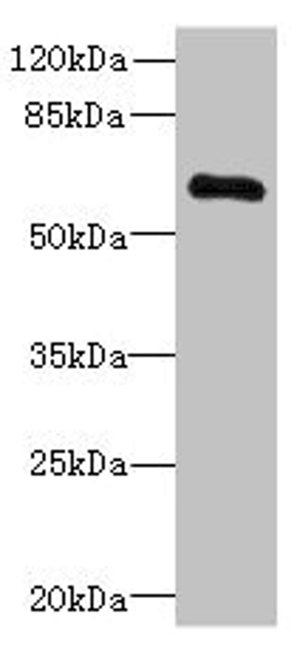 Western blot. All lanes: PPP2R1B antibody at 3.33µg/ml + Jurkat whole cell lysate. Secondary. Goat polyclonal to rabbit IgG at 1/10000 dilution. Predicted band size: 67, 74, 62, 53 kDa. Observed band size: 67 kDa