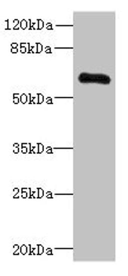 Western blot. All lanes: PPP2R1B antibody at 3.33µg/ml + Jurkat whole cell lysate. Secondary. Goat polyclonal to rabbit IgG at 1/10000 dilution. Predicted band size: 67, 74, 62, 53 kDa. Observed band size: 67 kDa