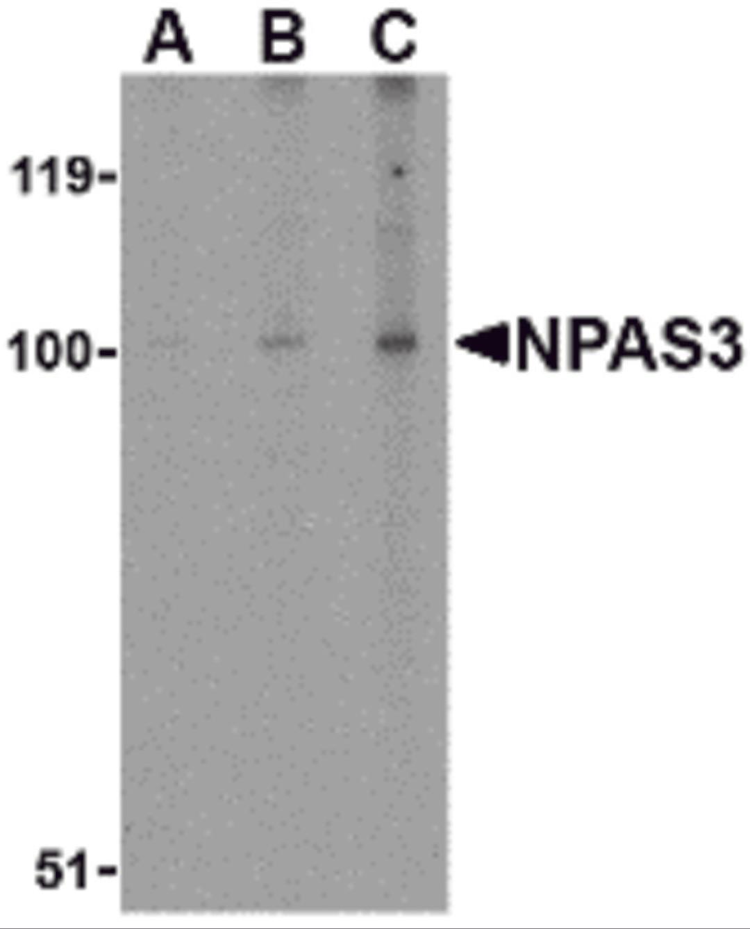 Western blot analysis of NPAS3 in rat brain tissue lysate with NPAS3 antibody at (A) 0.5, (B) 1 and (C) 2 μg/mL.