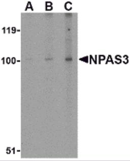 Western blot analysis of NPAS3 in rat brain tissue lysate with NPAS3 antibody at (A) 0.5, (B) 1 and (C) 2 μg/mL.