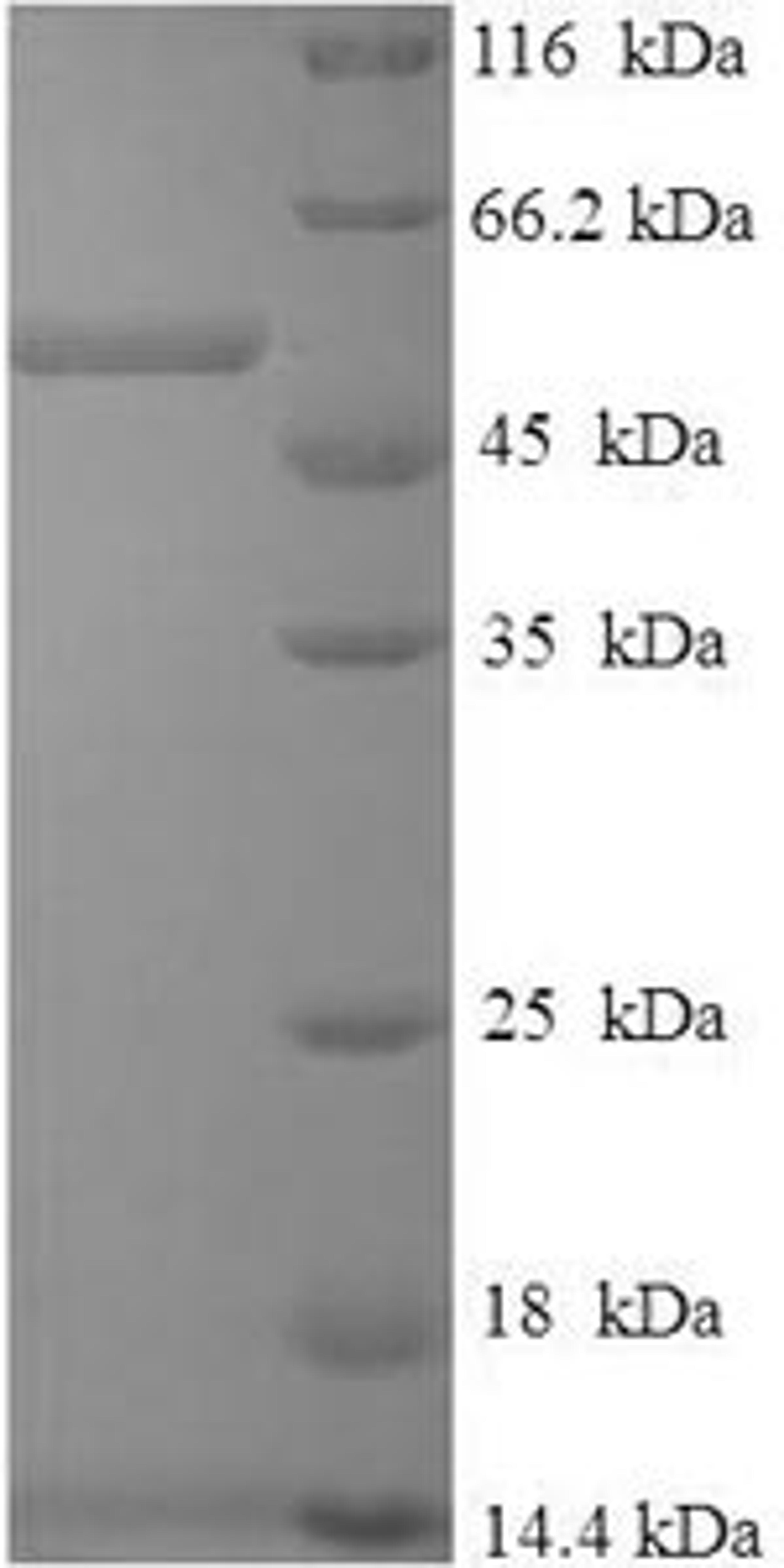 (Tris-Glycine gel) Discontinuous SDS-PAGE (reduced) with 5% enrichment gel and 15% separation gel.