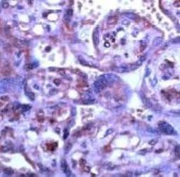 Immunohistochemistry: MMP-15/MT2-MMP Antibody [NB600-1486] - Human placenta stained with Anti-MMP-15 antibody, Cat# NB600-1486