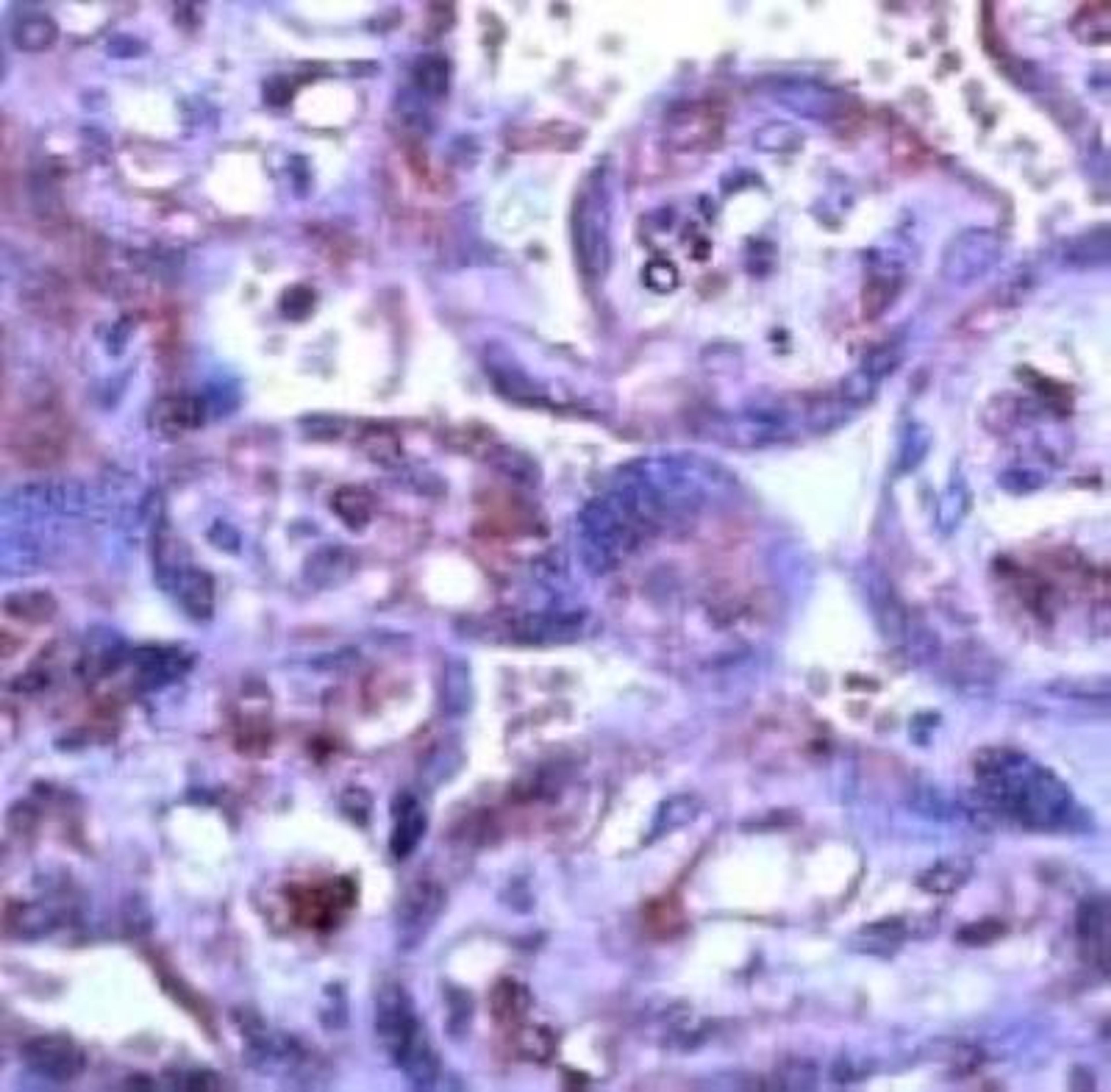 Immunohistochemistry: MMP-15/MT2-MMP Antibody [NB600-1486] - Human placenta stained with Anti-MMP-15 antibody, Cat# NB600-1486