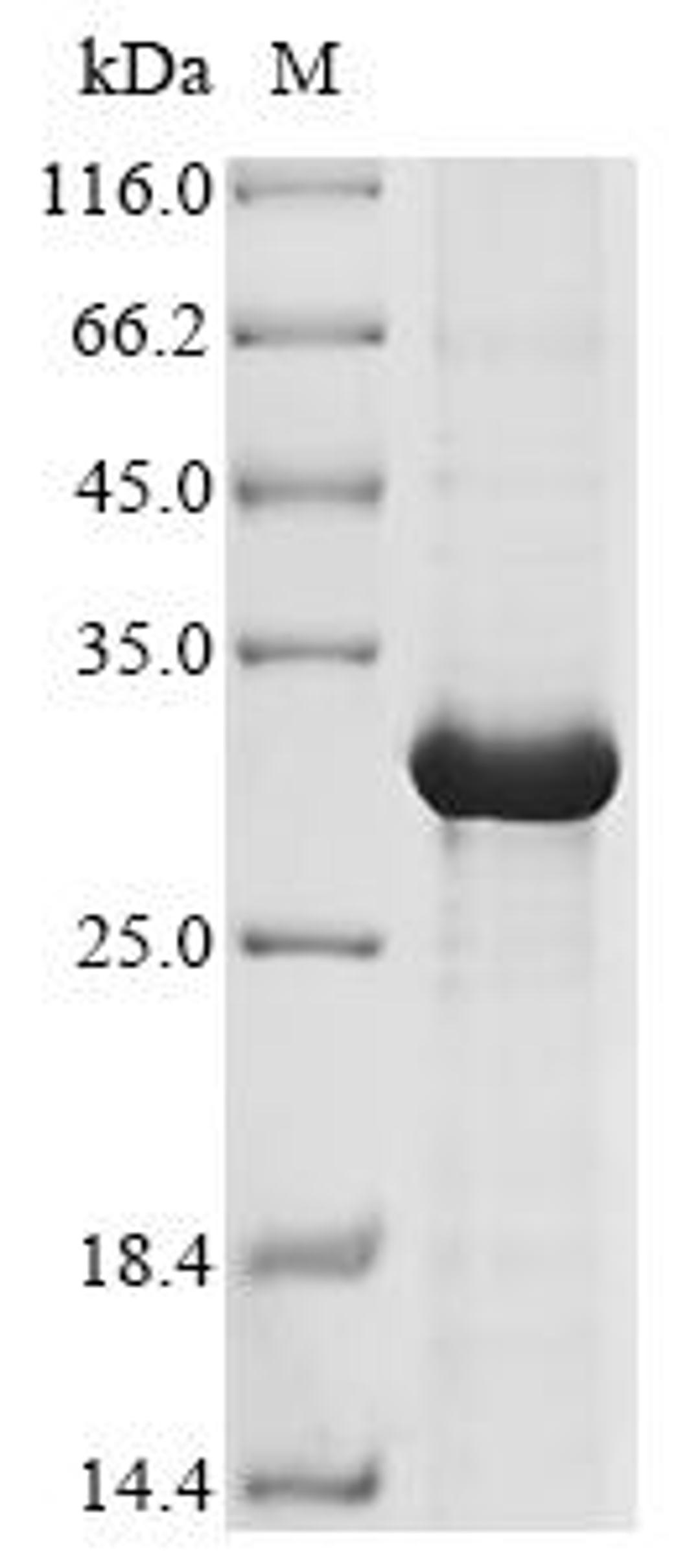 (Tris-Glycine gel) Discontinuous SDS-PAGE (reduced) with 5% enrichment gel and 15% separation gel.
