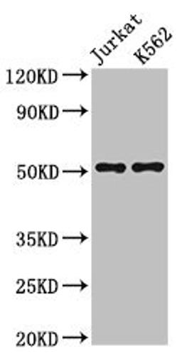 Western Blot. Positive WB detected in: Jurkat whole cell lysate, K562 whole cell lysate. All lanes: FLI1 antibody at 3µg/ml. Secondary. Goat polyclonal to rabbit IgG at 1/50000 dilution. Predicted band size: 51, 44, 48, 30 kDa. Observed band size: 51 kDa