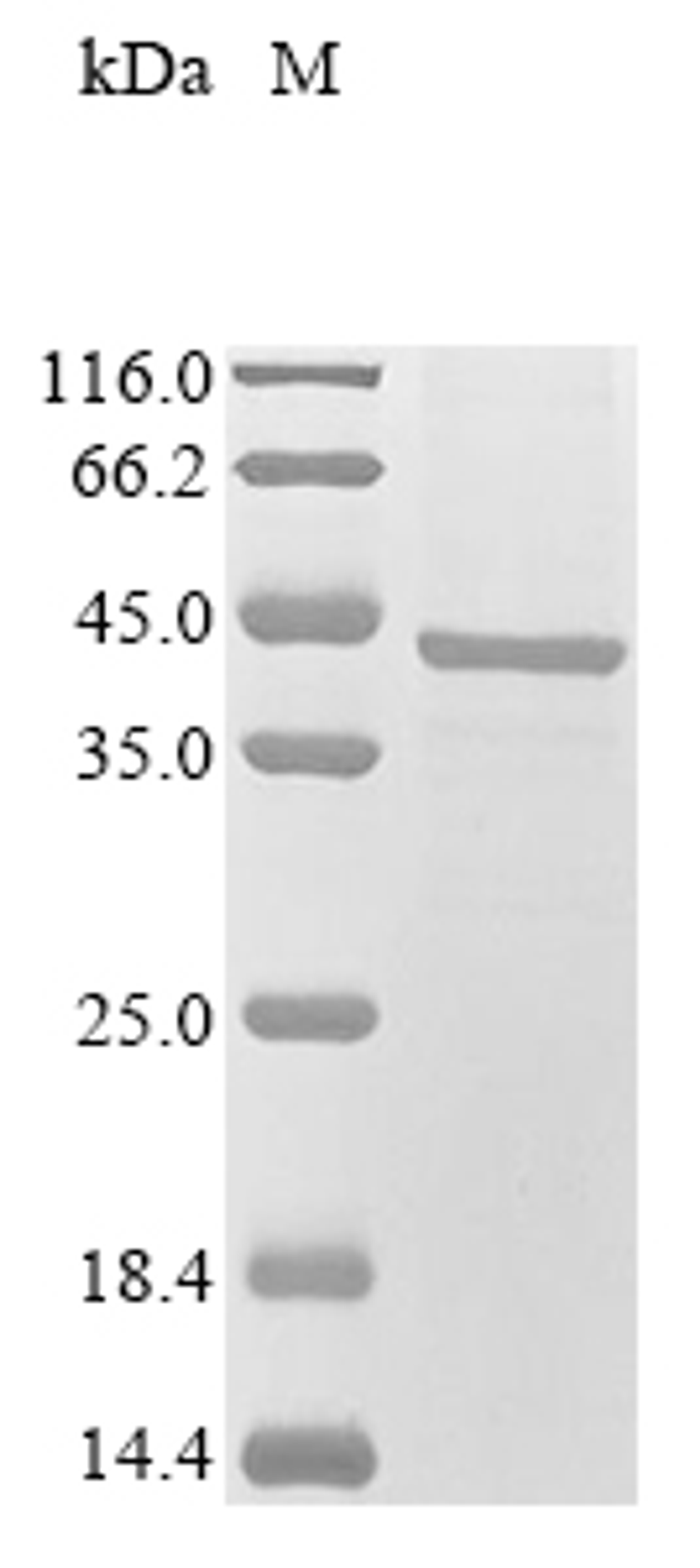 (Tris-Glycine gel) Discontinuous SDS-PAGE (reduced) with 5% enrichment gel and 15% separation gel.