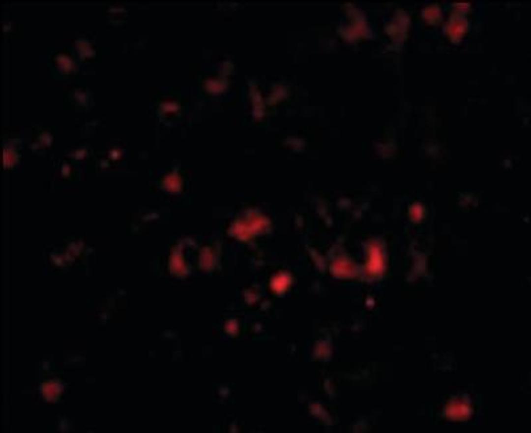 Immunocytochemistry/Immunofluorescence: Neuronal Pentraxin 2 Antibody [NBP1-50275] - Analysis of anti-NPTX2 antibody with human brain cells.