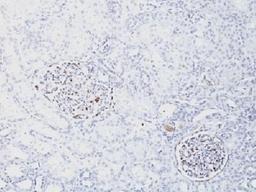 IHC testing of FFPE human kidney with recombinant WT1 antibody (clone WT1/1434R). HIER: steam sections in 10mM citrate buffer, pH 6.0, for 10-20 min.