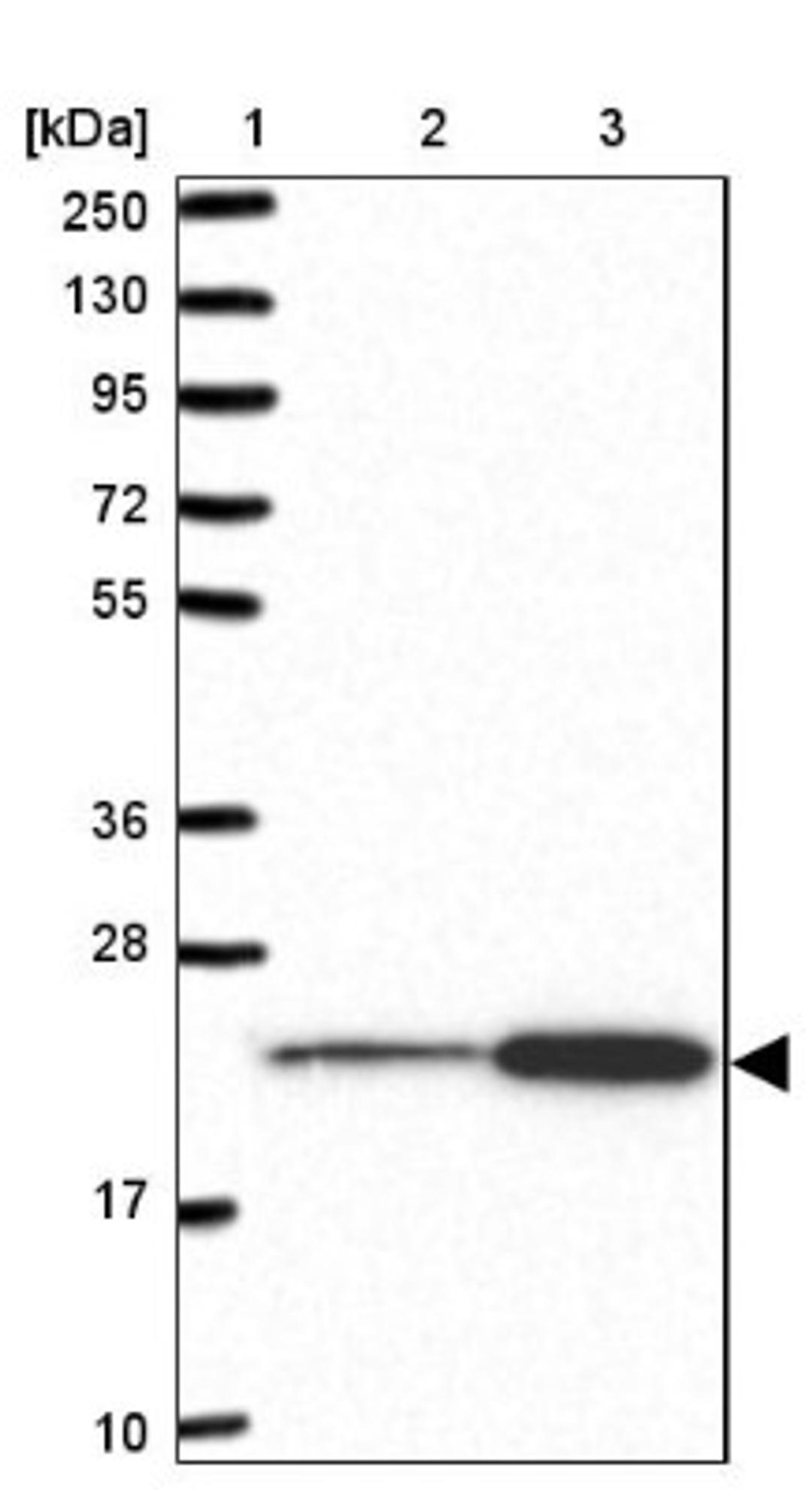 Western Blot: RPL18 Antibody [NBP2-13251] - Lane 1: Marker [kDa] 250, 130, 95, 72, 55, 36, 28, 17, 10<br/>Lane 2: Human cell line RT-4<br/>Lane 3: Human cell line U-251MG sp