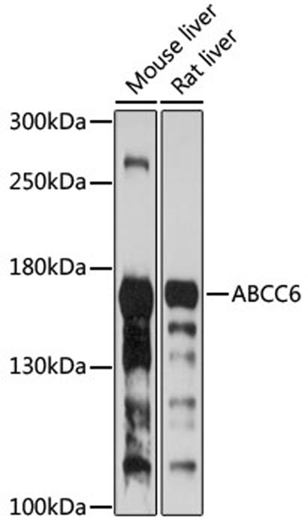 Western blot - ABCC6 antibody (A8100)