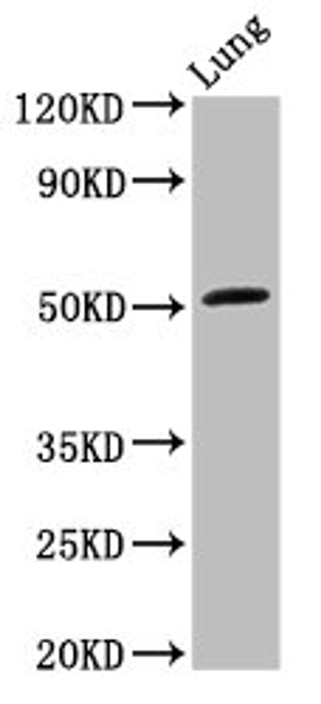 Western Blot. Positive WB detected in: Rat lung tissue. All lanes: ARHGAP1 antibody at 3.2ug/ml. Secondary. Goat polyclonal to rabbit IgG at 1/50000 dilution. Predicted band size: 51 kDa. Observed band size: 51 kDa.