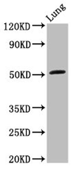 Western Blot. Positive WB detected in: Rat lung tissue. All lanes: ARHGAP1 antibody at 3.2ug/ml. Secondary. Goat polyclonal to rabbit IgG at 1/50000 dilution. Predicted band size: 51 kDa. Observed band size: 51 kDa.