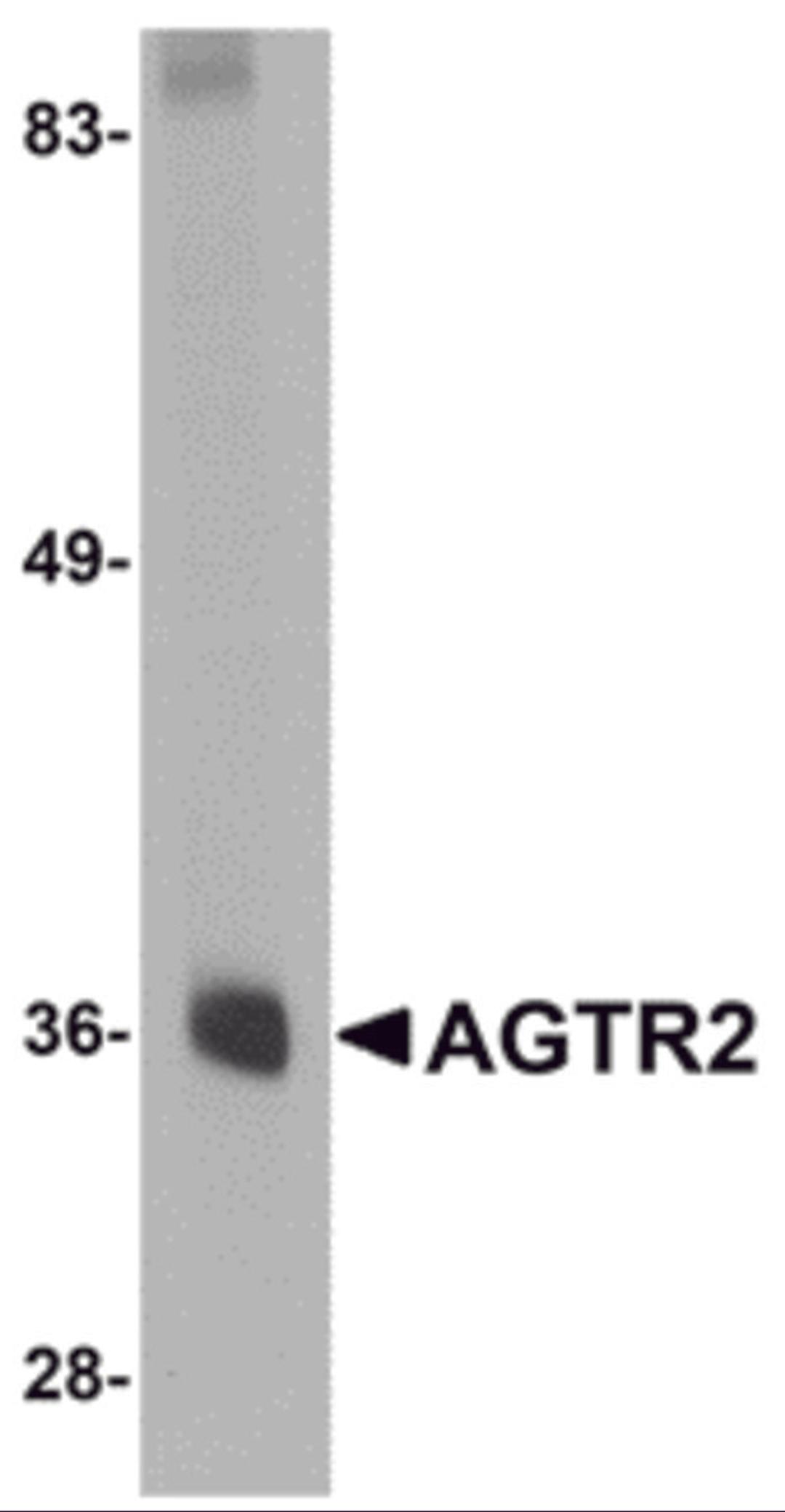 Western blot analysis of AGTR2 in mouse liver tissue lysate with AGTR2 antibody at 0.5 μg/mL.