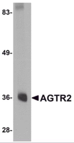 Western blot analysis of AGTR2 in mouse liver tissue lysate with AGTR2 antibody at 0.5 μg/mL.