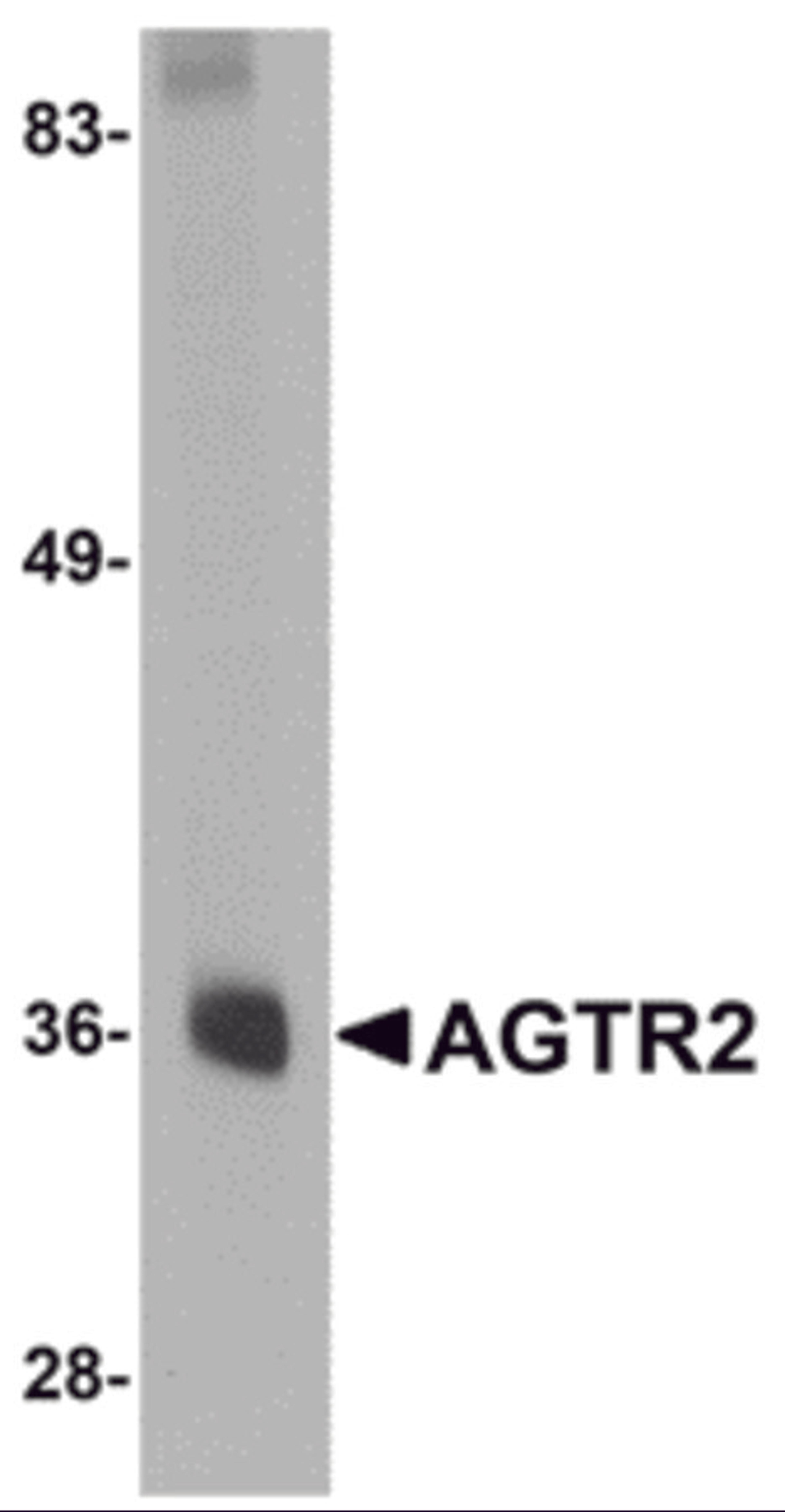 Western blot analysis of AGTR2 in mouse liver tissue lysate with AGTR2 antibody at 0.5 μg/mL.