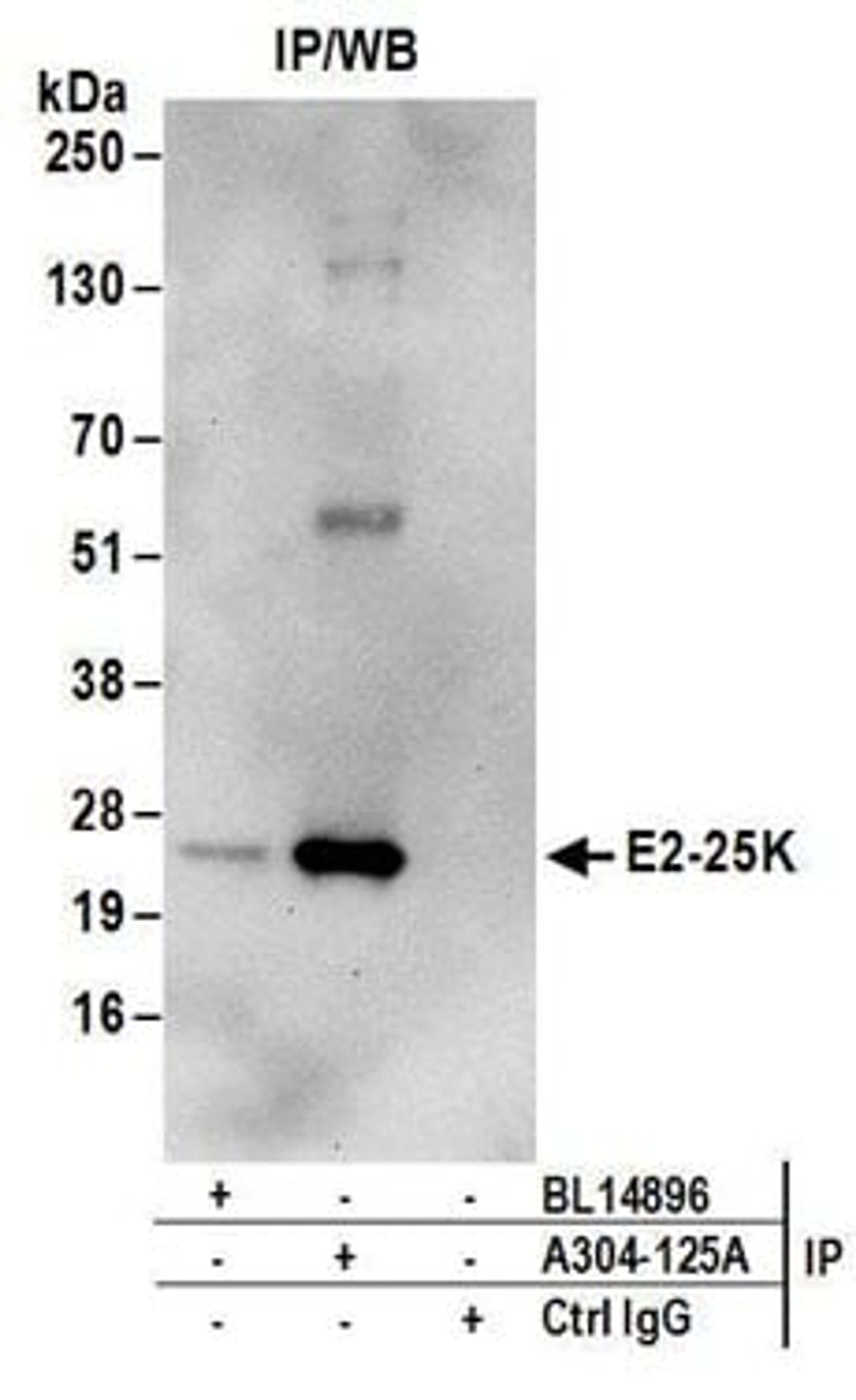 Detection of human E2-25K by western blot of immunoprecipitates.