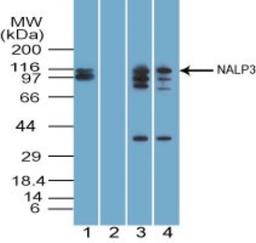 Western Blot: NALP3 Antibody [NBP2-12446] - Analysis of NALP3 using NALP3 antibody. Human testis lysate in the 1) absence, 2) presence of immunizing peptide, 3) mouse and 4) rat testis probed with NALP3 antibody at 5, 2 and 2 ug/ml respectively. goat anti-rabbit Ig HRP secondary antibody and PicoTect ECL substrate solution were used for this test.