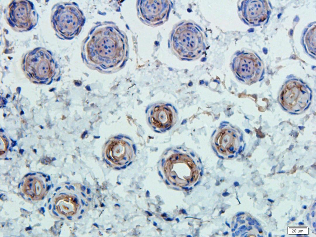 Immunohistochemical staining of mouse skin tissue using CD45 antibody (dilution of primary antibody - 1:100)