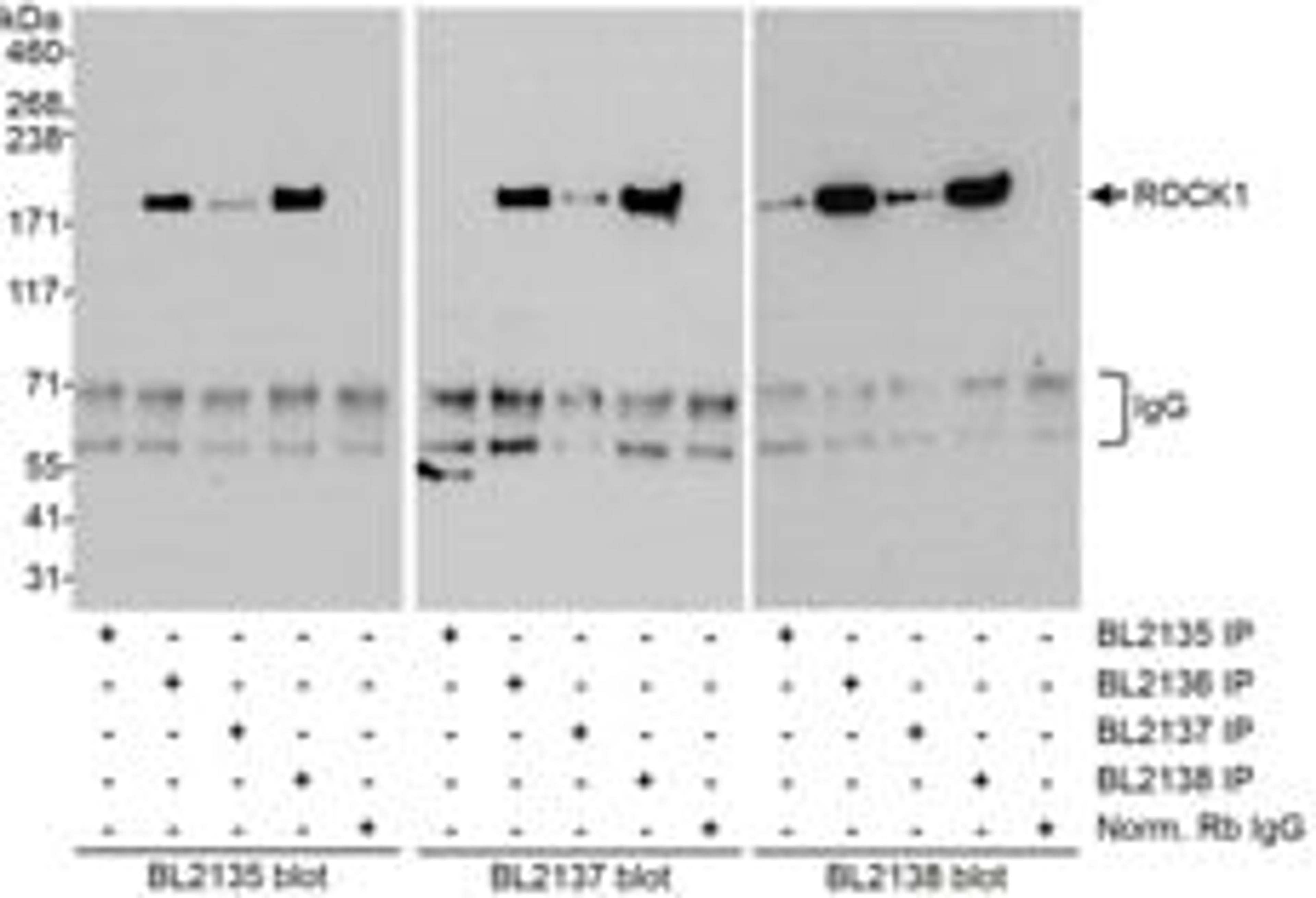 Detection of human ROCK1 by western blot of immunoprecipitates.