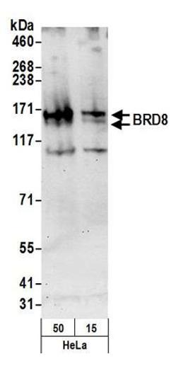 Detection of human BRD8 by western blot.