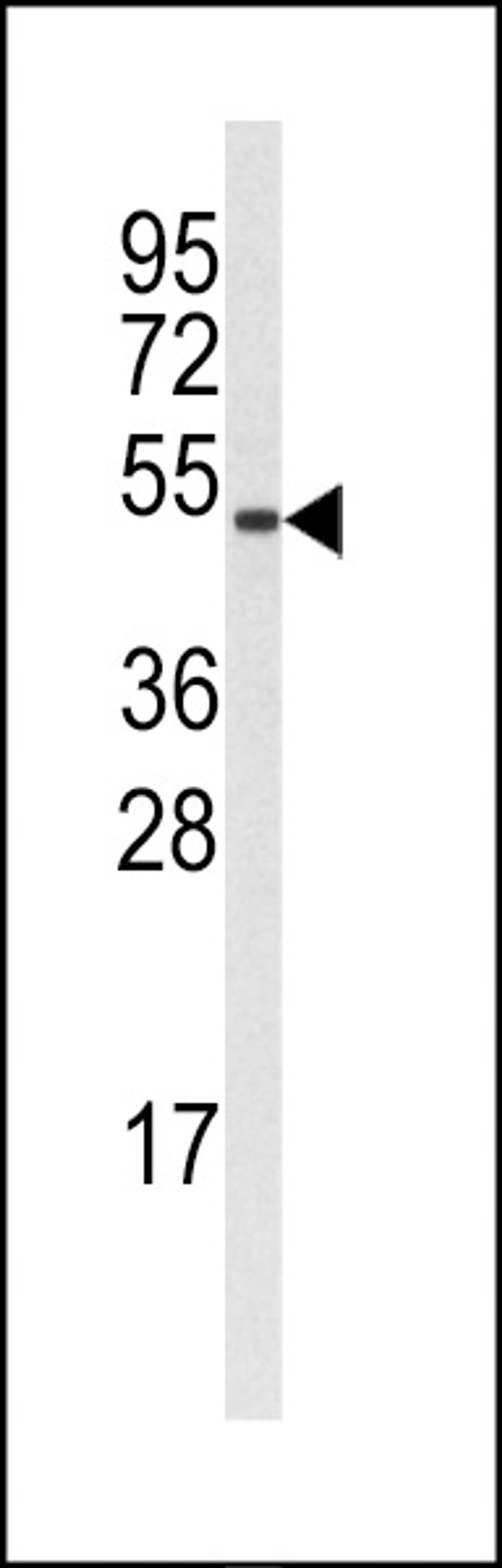 Western blot analysis of (S126) in A375 cell line lysates (35ug/lane)